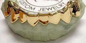 10K Gold Grillz