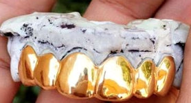 18K Gold Grillz